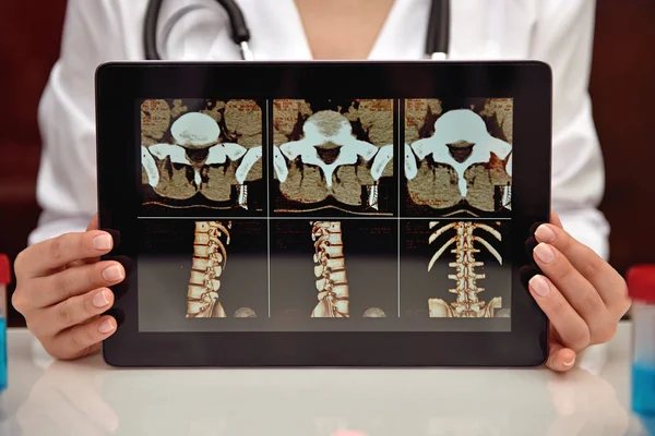Mujer Mostrando rayos X —  Fotos de Stock