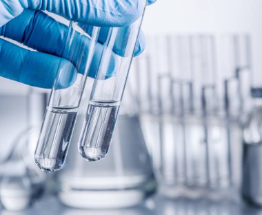 Laboratuvar kadehler analist'ın elinde plastik eldiven.