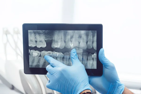 牙科医生在片剂上显示 x 光片 — 图库照片