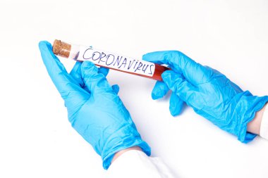Coronavirus Covid 19, Coronavirus covid 19 araştırma laboratuarındaki bilim adamı doktor biyolojik tehlike koruma giysisinin örnek tüpünden enfekte olmuş kan örneği.