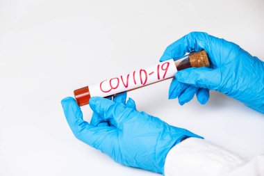 Coronavirus Covid 19, Coronavirus covid 19 araştırma laboratuarındaki bilim adamı doktor biyolojik tehlike koruma giysisinin örnek tüpünden enfekte olmuş kan örneği.