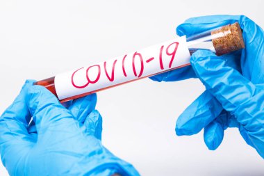 Coronavirus Covid 19, Coronavirus covid 19 araştırma laboratuarındaki bilim adamı doktor biyolojik tehlike koruma giysisinin örnek tüpünden enfekte olmuş kan örneği.