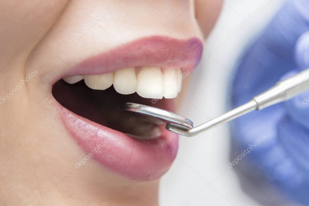 Woman at Dental checkup