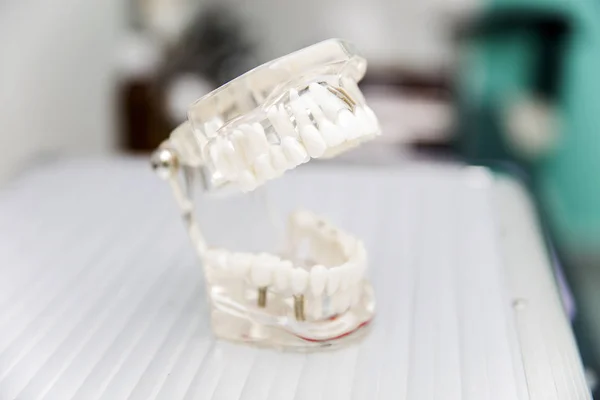 Modellen proteser i tandläkarens — Stockfoto