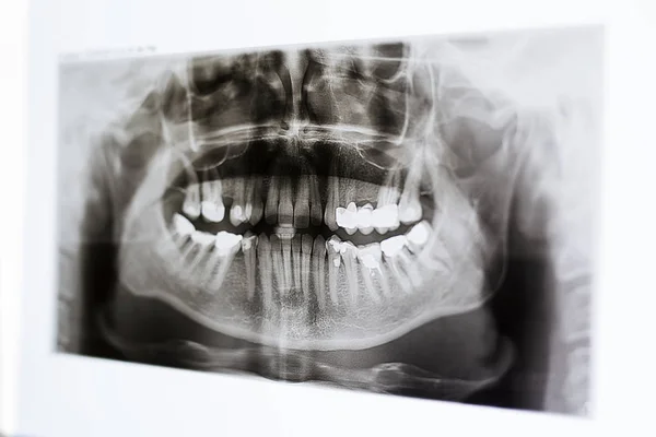 X-rays of the jaw and teeth