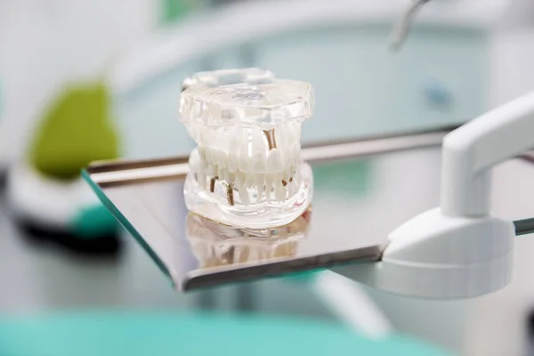 Модельные протезы в стоматологическом кабинете — стоковое фото