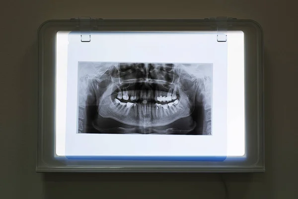 X-rays of the jaw and teeth