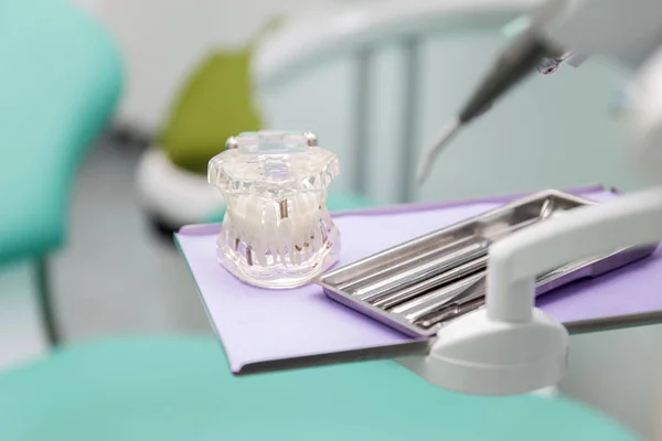 Model kunstgebitten in tandheelkundige kantoor — Stockfoto