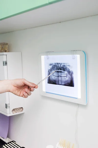 Zubní rentgenové analýzy — Stock fotografie