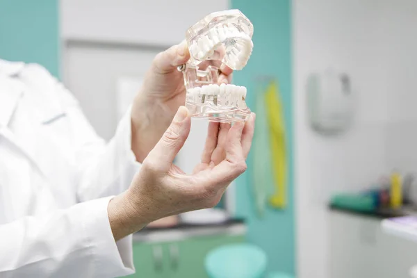 Стоматолог тримає модель зубних протезів — стокове фото