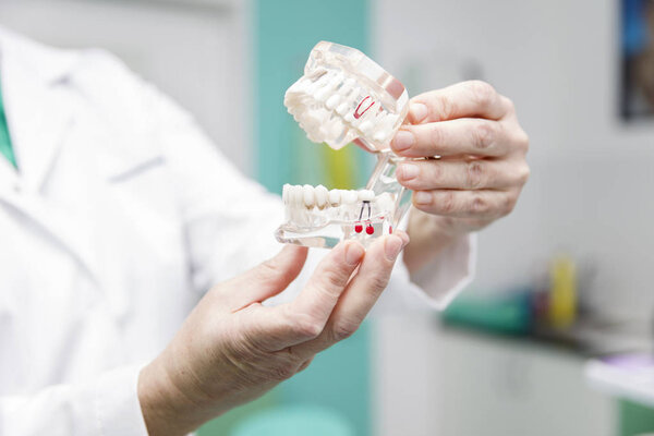 Dentist holding dentures model