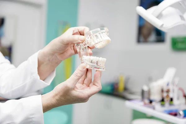 Модель зубного протеза у стоматолога — стоковое фото