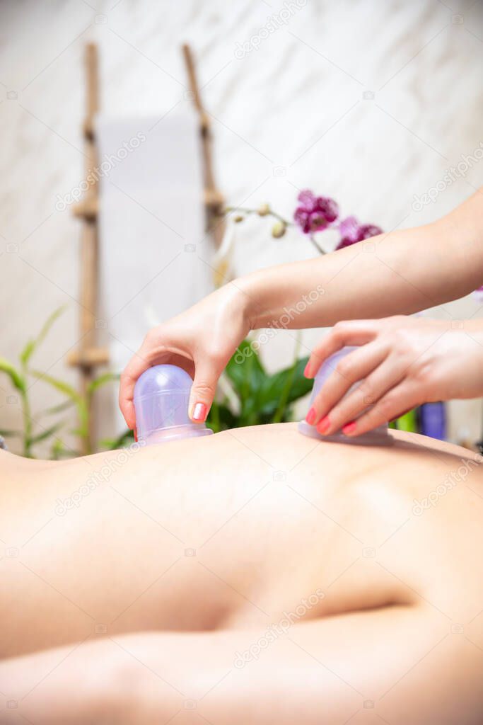 Closeup of cups applied to back skin of a female patient as part of the traditional method of cupping therapy