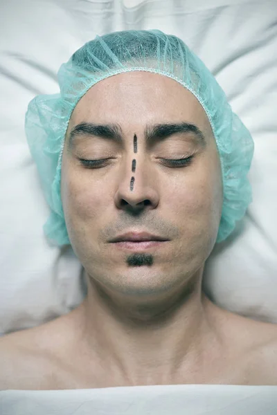 Homme sur le point d'avoir une rhinoplastie — Photo