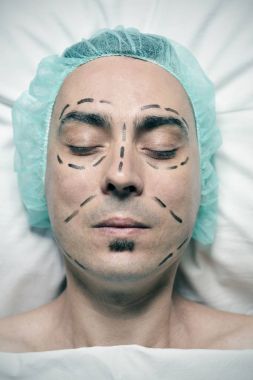 adam bir plastik cerrahi için