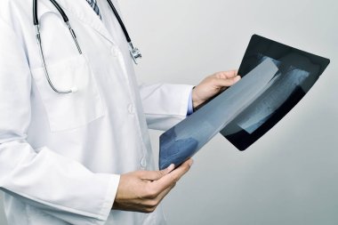 bazı ilerlemenin gözlemleyerek doktor