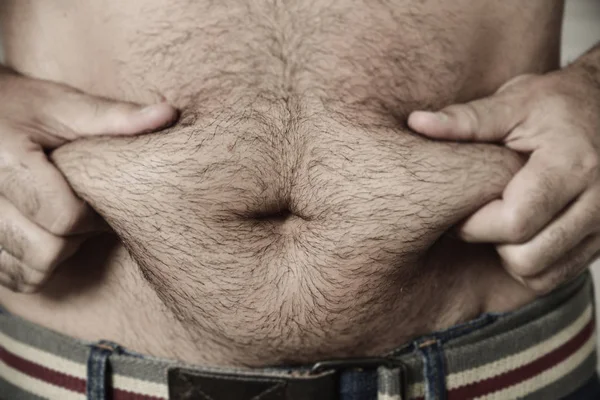 Man grabbing the fat of his stomach — Stock Photo, Image