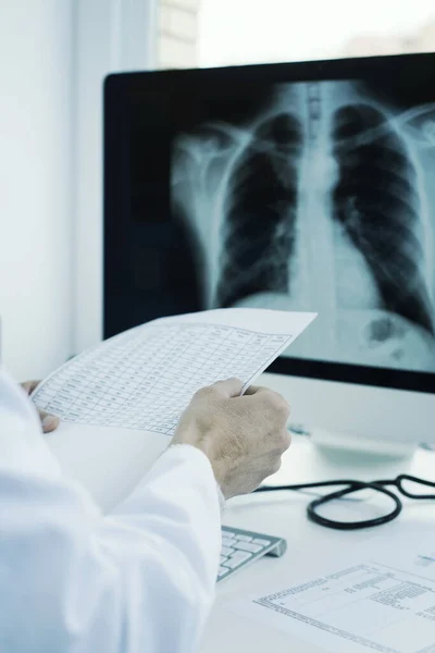 一位身穿白衣的年轻医生的特写镜头 坐在办公桌前检查电脑上的测试结果和胸部X光片 — 图库照片