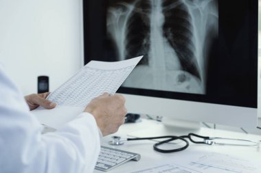 Masasında oturan beyaz önlüklü genç bir doktor bilgisayarında test ve göğüs röntgeni sonuçlarını kontrol ediyor.