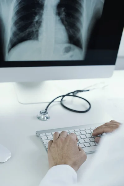 一位身穿白衣的年轻医生的特写镜头 坐在办公桌前检查电脑里的胸片 — 图库照片