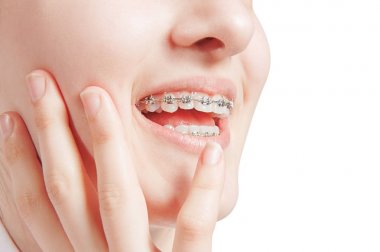 Güzel genç kadın diş diş teli ile