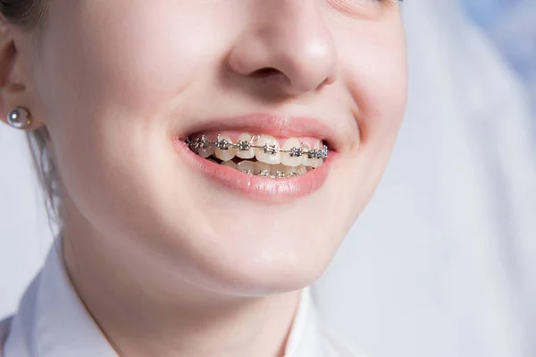Jovem com aparelho dentário — Fotografia de Stock