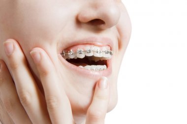 Güzel genç kadın diş diş teli ile