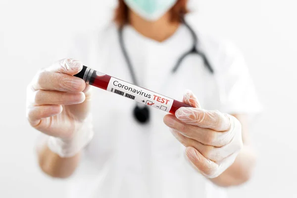 新しい急速に普及したコロナウイルスのための肯定的な血液検査の結果を保持する看護師 — ストック写真