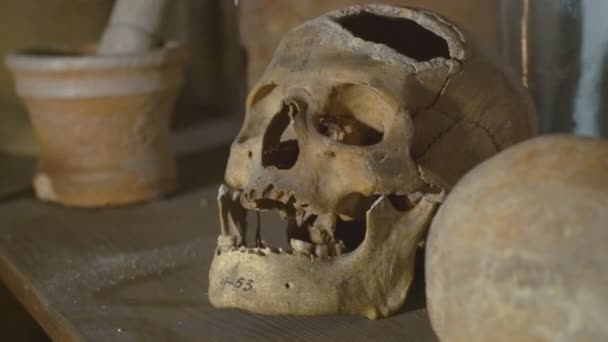 Skull Found During the Excavation of a Medical Hole in the Frontal Bone. Operation on the Human Skull in Ancient Times — ストック動画