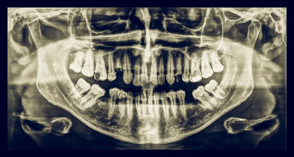 Vintage patrząc medycznych Xray — Zdjęcie stockowe