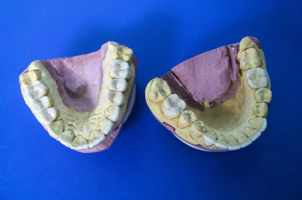 Model of the jaws on the dentist's desk on a blue background — Stock Photo, Image