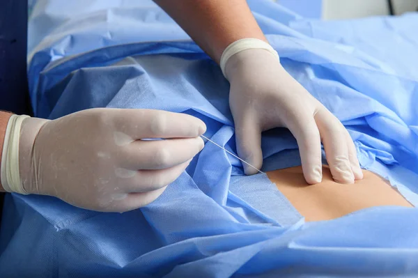 Équipe de chirurgiens orthopédistes aux urgences en uniforme stérile pratiquant une chirurgie sur une colonne vertébrale humaine, au cimetière de la colonne vertébrale — Photo