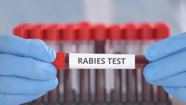 Laboratorieassistent bär skyddshandskar håller flaskan med rabies test — Stockvideo