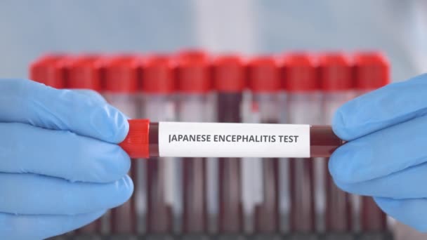 Laboratorní asistent v ochranných rukavicích drží injekční lahvičku s japonským testem encefalitidy — Stock video