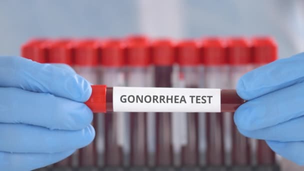 A védőkesztyűt viselő laboratóriumi asszisztens gonorrhea teszttel ellátott injekciós üveget tart. — Stock videók