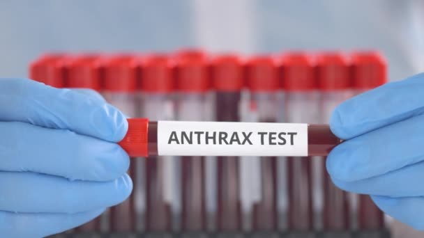 Laboratory assistant wearing protection gloves holds vial with anthrax test — Stock Video