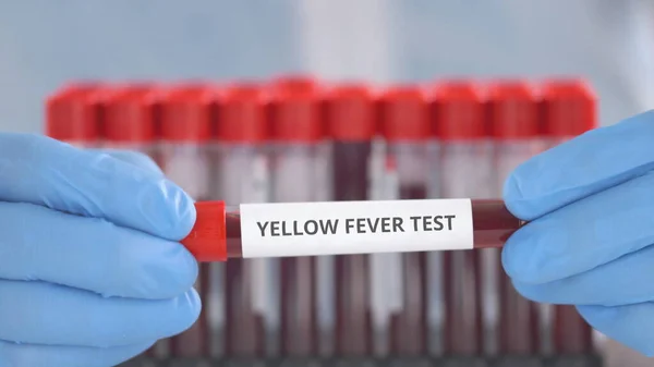 Laboratorieassistent bär skyddshandskar håller laboratorietubb med gula febern test — Stockfoto