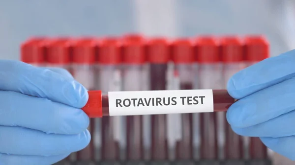 Asistente de laboratorio con guantes de protección sostiene vial con prueba de rotavirus — Foto de Stock
