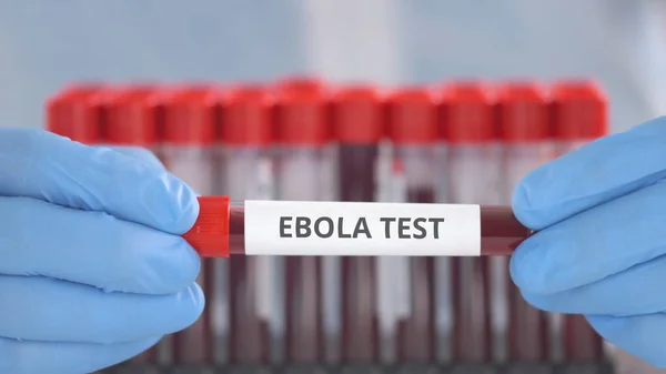 Laborassistentin mit Schutzhandschuhen hält Laborröhrchen mit Ebola-Test — Stockfoto