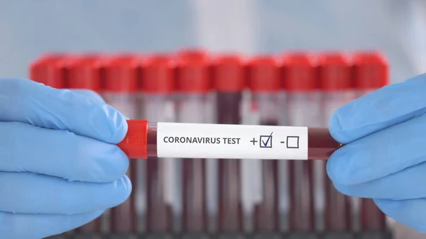 Laborantin mit Schutzhandschuhen hält Fläschchen mit positivem Coronavirus-Test — Stockfoto