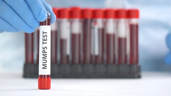 Laboratoriearbetare med skyddshandske sätter laboratorierör med påssjuka på bordet — Stockfoto