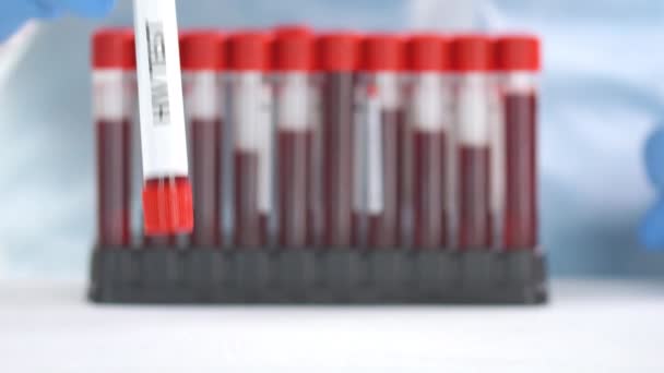 Trabajador de laboratorio con guante protector pone tubo de laboratorio con prueba de VIH en la mesa — Vídeos de Stock