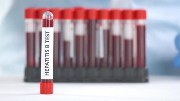 Hand dragen van beschermhandschoen zet injectieflacon met hepatitis B-test op tafel — Stockvideo