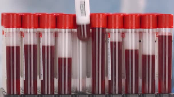 Mão usando luva de proteção coloca frasco com teste de vírus zika no rack de tubo — Vídeo de Stock