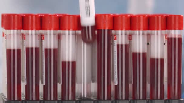 Laboratory worker wearing protection glove puts laboratory tube with yellow fever test in the tube rack — Stock Video