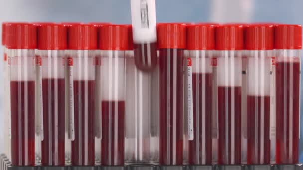 Kézzel viselt védőkesztyű teszi injekciós üveg pneumonia teszt a cső állvány — Stock videók