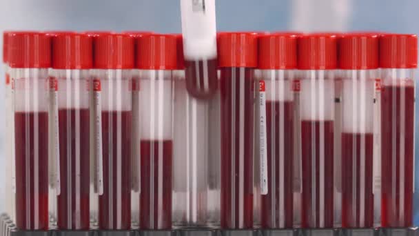 A védőkesztyűt viselő laboratóriumi dolgozó a csőtartóba helyezi a HIV-teszttel ellátott laboratóriumi csövet. — Stock videók