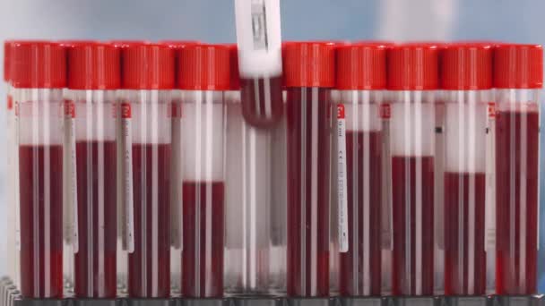 Laboratoriummedewerker in beschermende handschoen plaatst laboratoriumbuis met hepatitis E-test in het buizenrek — Stockvideo