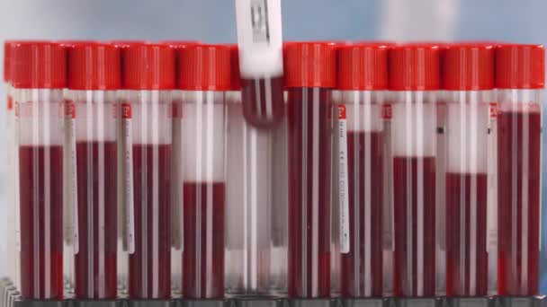 Kézzel viselt védőkesztyű teszi injekciós üveg rákos teszt a cső állvány — Stock videók
