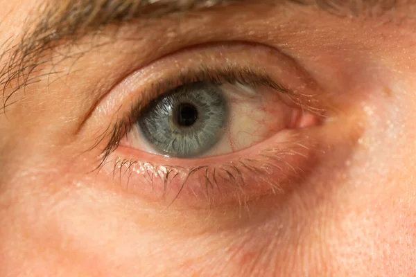 Ojo Del Hombre Gris Azul Con Venas Rojas Muy Cerca — Foto de Stock